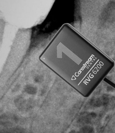 carestream rvg diş hekimi röntgen