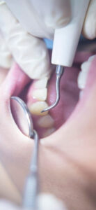 Picture of Periodontoloji
